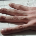 diabetiku draugas.jpg